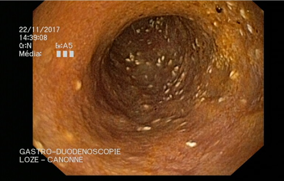 Formation ENDO-CF : Techniques d'endoscopie digestive et respiratoire