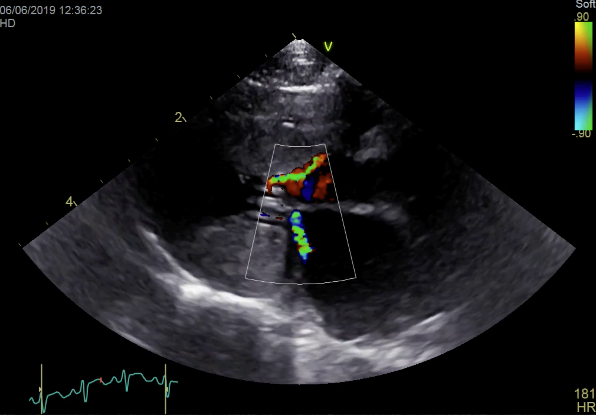 Formation CY-CARCT : Cycle en cardiologie f&eacute;line