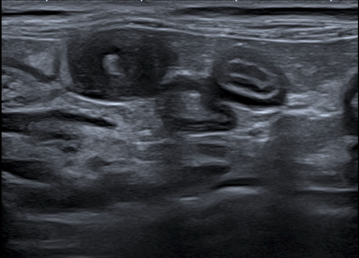 Formation CY-ABD-2 : Cycle en &eacute;chographie abdominale canine et f&eacute;line - Partie 2