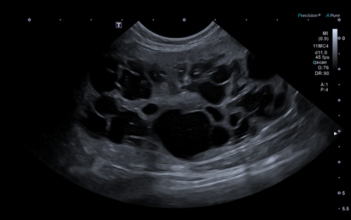 Formation EAP2 : Echographie abdominale pathologique - appareil urinaire, appareil g&eacute;nital