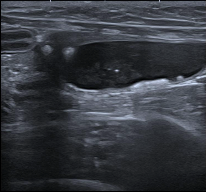 Formation EAP2-LIVE : Echographie abdominale pathologique: Appareil urinaire et g&eacute;nital