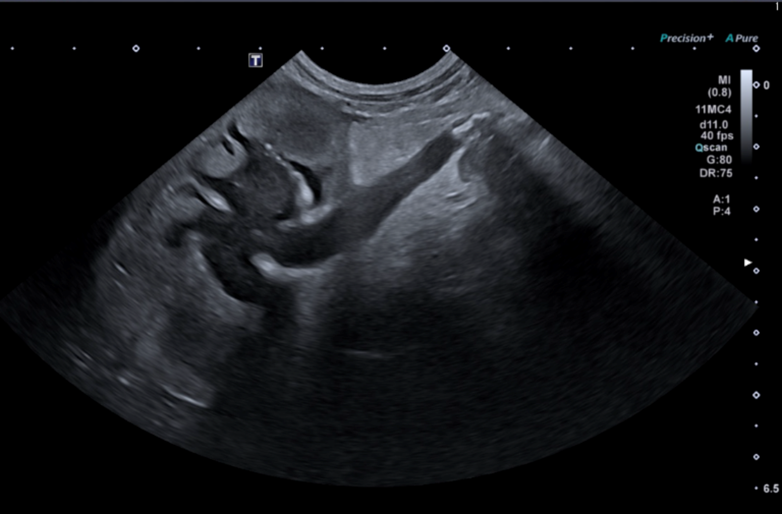Formation EAP3 : Echographie abdominale pathologique : Tube digestif, pancr&eacute;as et surr&eacute;nales