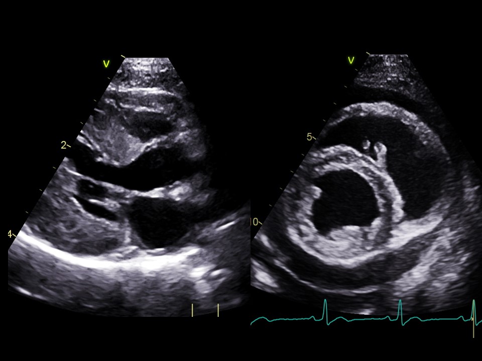 Formation EC002B : Echocardiographie : Modes BD et TM - Aspects l&eacute;sionnels (cas cliniques)