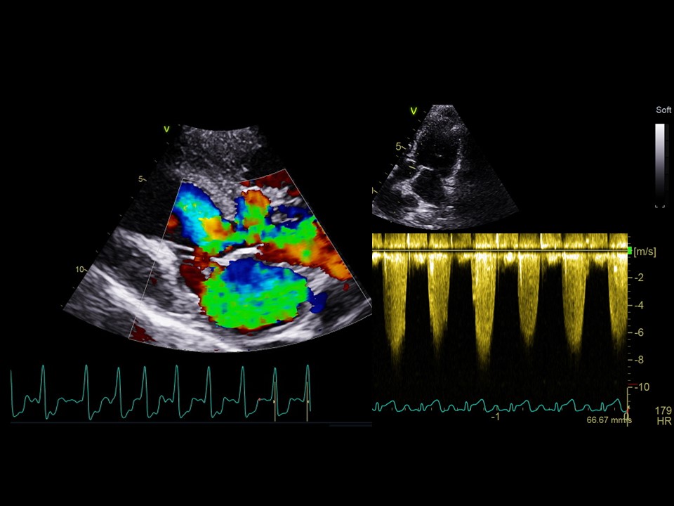 Formation EC004 : Echographie Doppler cardiaque : aspects l&eacute;sionnels (cas cliniques)