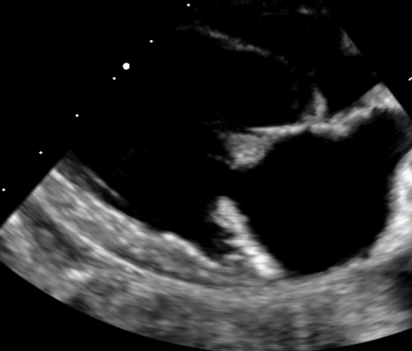 Formation EC0010 : Perfectionner ma pratique en &eacute;chocardiographie au quotidien &agrave; travers des cas cliniques. Partie 2.