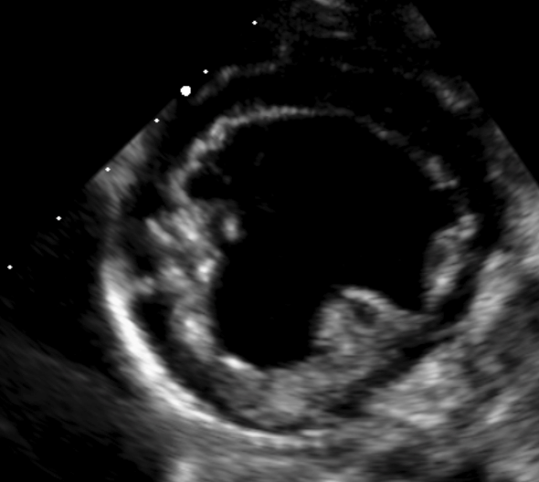 Formation EC009 : Perfectionner ma pratique en &eacute;chocardiographie au quotidien &agrave; travers des cas cliniques. Partie 1.
