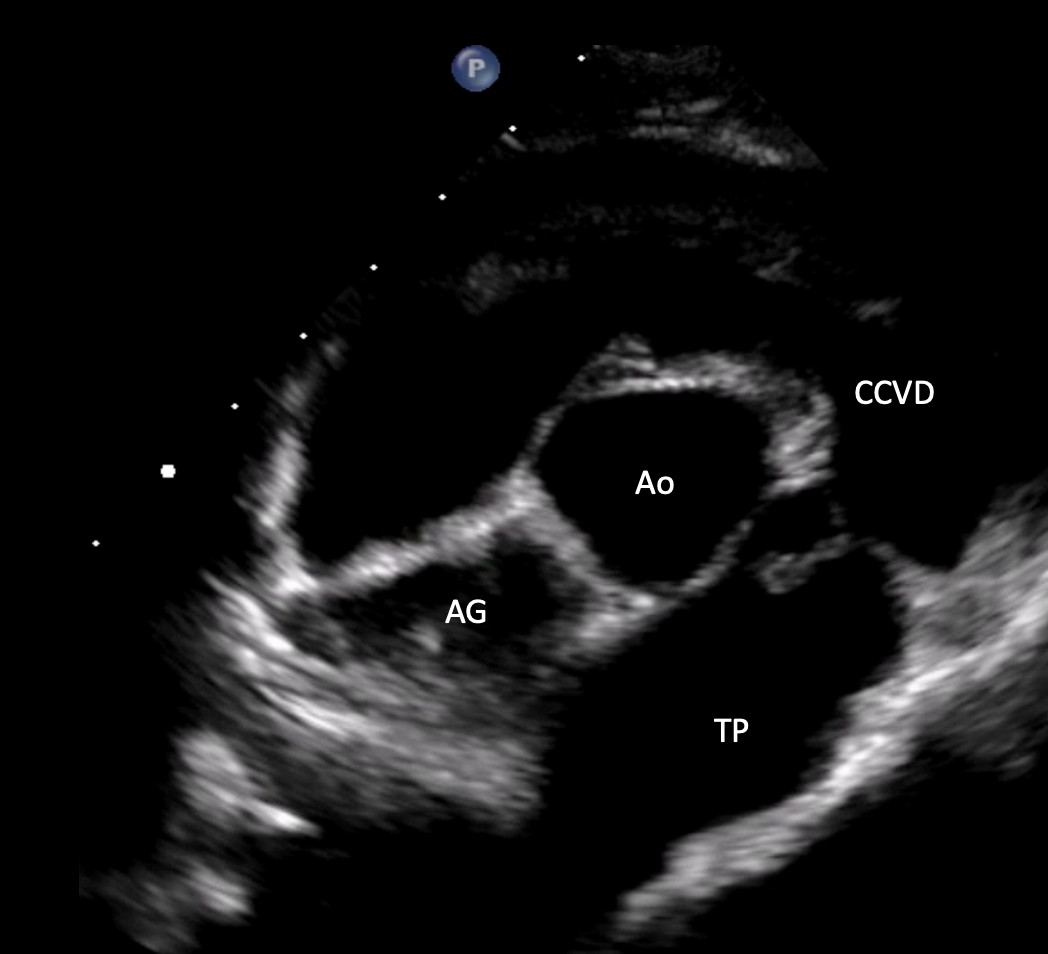 Formation EC0010 : Perfectionner ma pratique en &eacute;chocardiographie au quotidien &agrave; travers des cas cliniques. Partie 2.