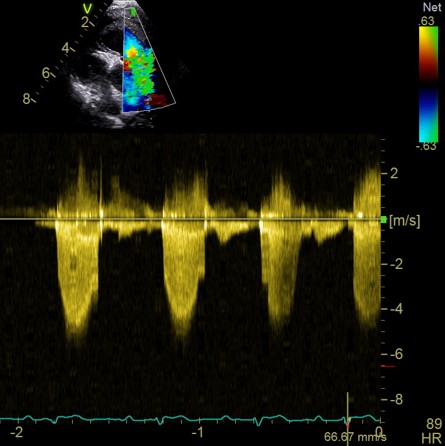 Formation CY-CAR : Cycle en cardiologie canine et f&eacute;line : m&eacute;decine et &eacute;chocardiographie