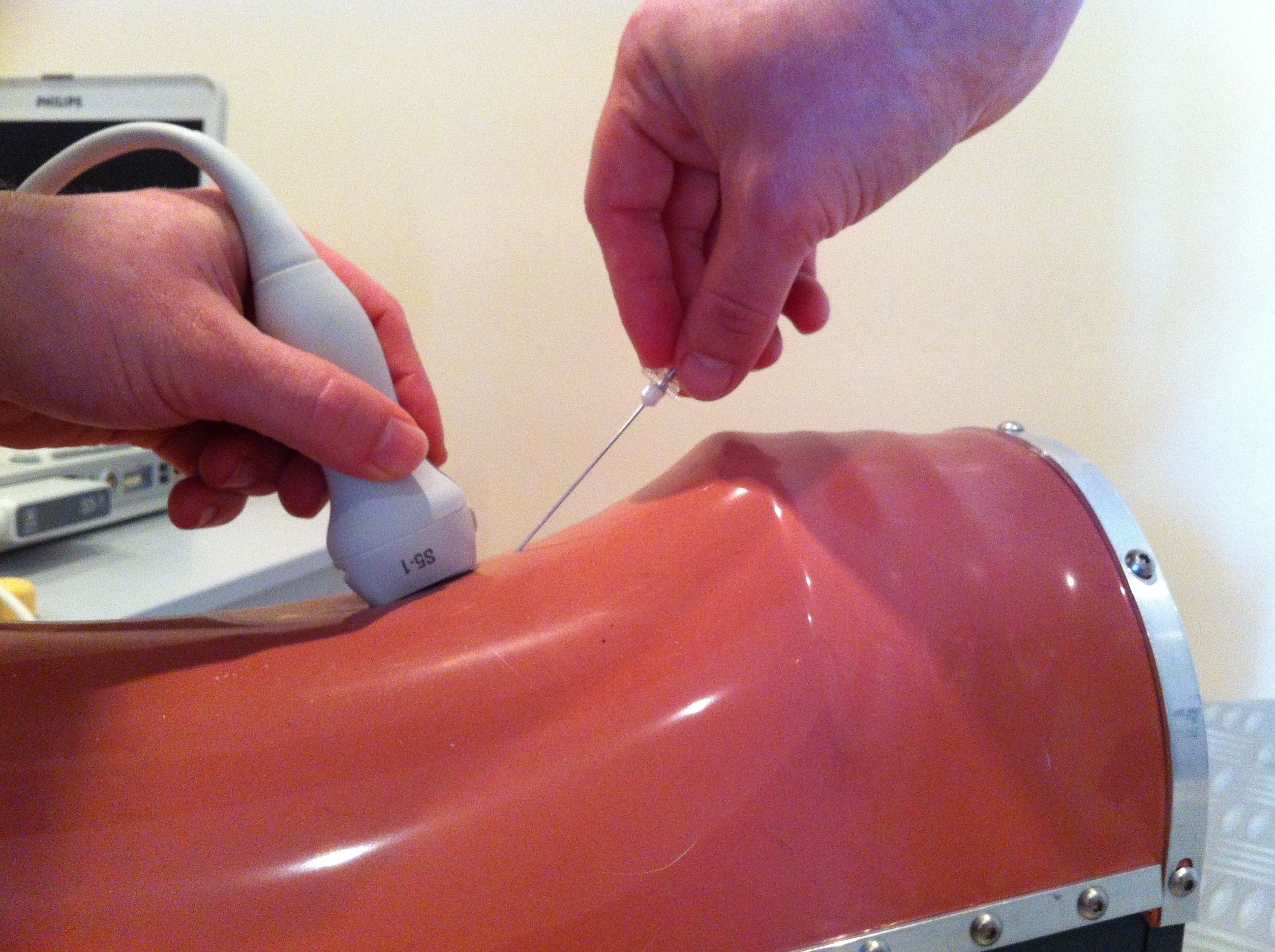Formation ECHOINT1 : Echographie: ponctions, biopsies, pr&eacute;l&egrave;vements &eacute;choguid&eacute;s /TP sur fant&ocirc;mes