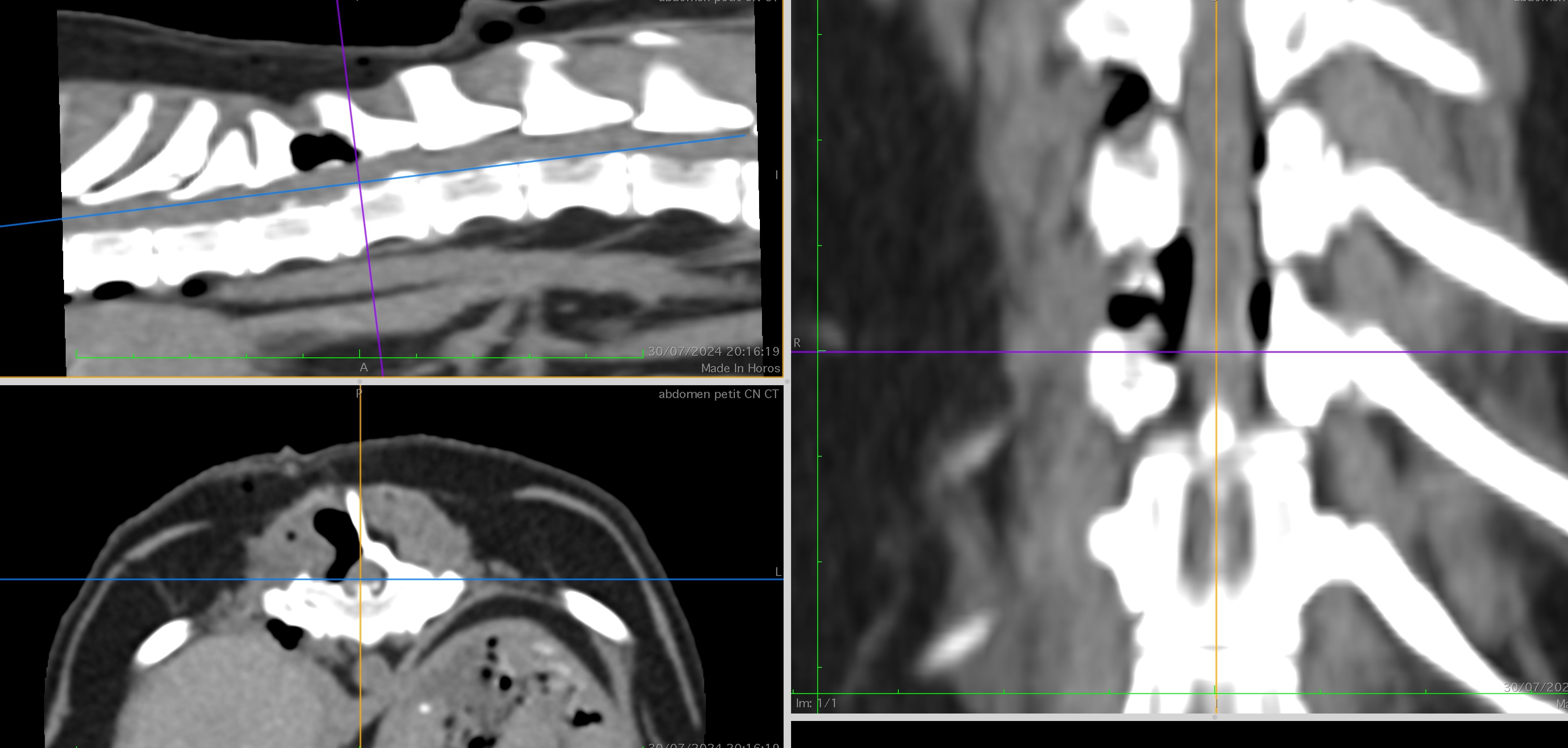 Formation NCHIR1 : Neurochirurgie de base : h&eacute;milaminectomie thoracolombaire et alternatives