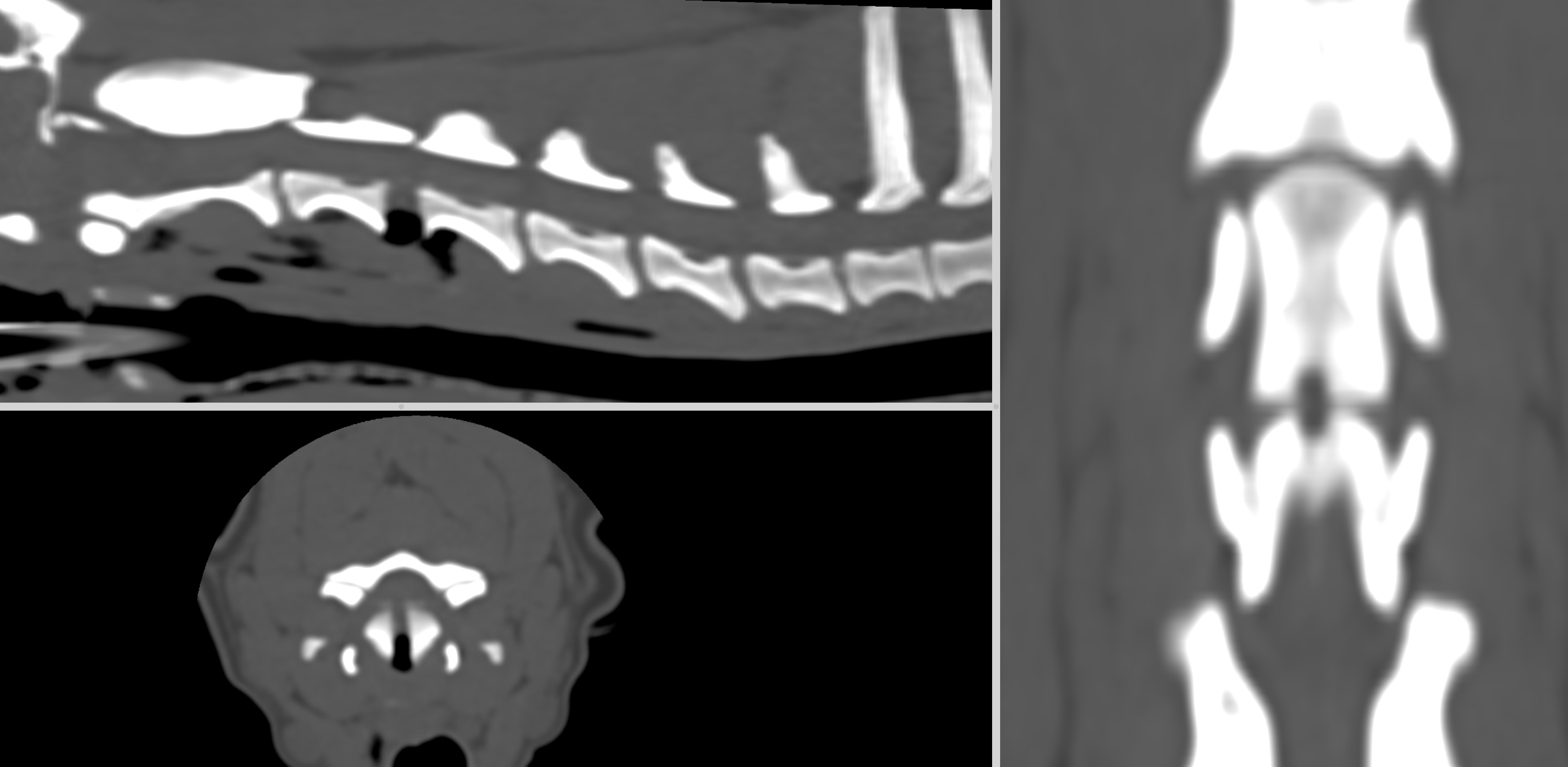 Formation NCHIR2-B : Neurochirurgie avanc&eacute;e : corpectomie cervicale et introduction &agrave; la stabilisation
