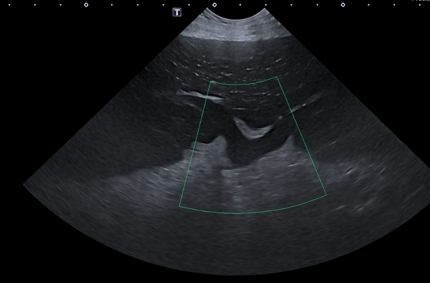 Formation CY-ABD-2 : Cycle en &eacute;chographie abdominale canine et f&eacute;line - Partie 2