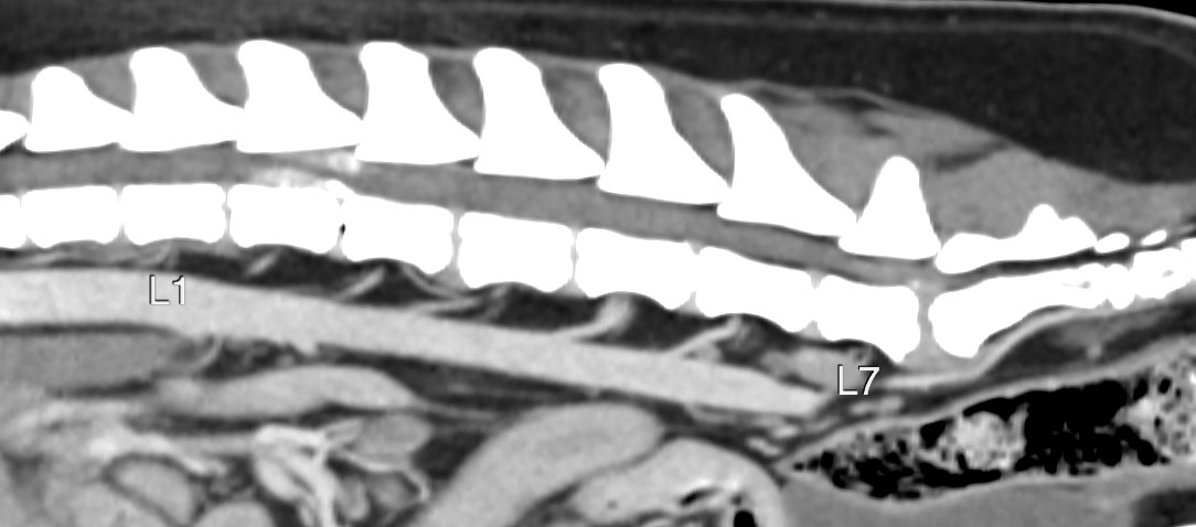 Formation SCANB : Module Scanner: Niveau 2: Vasculaire thoracique et abdominal, tube digestif, surr&eacute;nales, affections naso-sinusales, c&eacute;rebrales...
