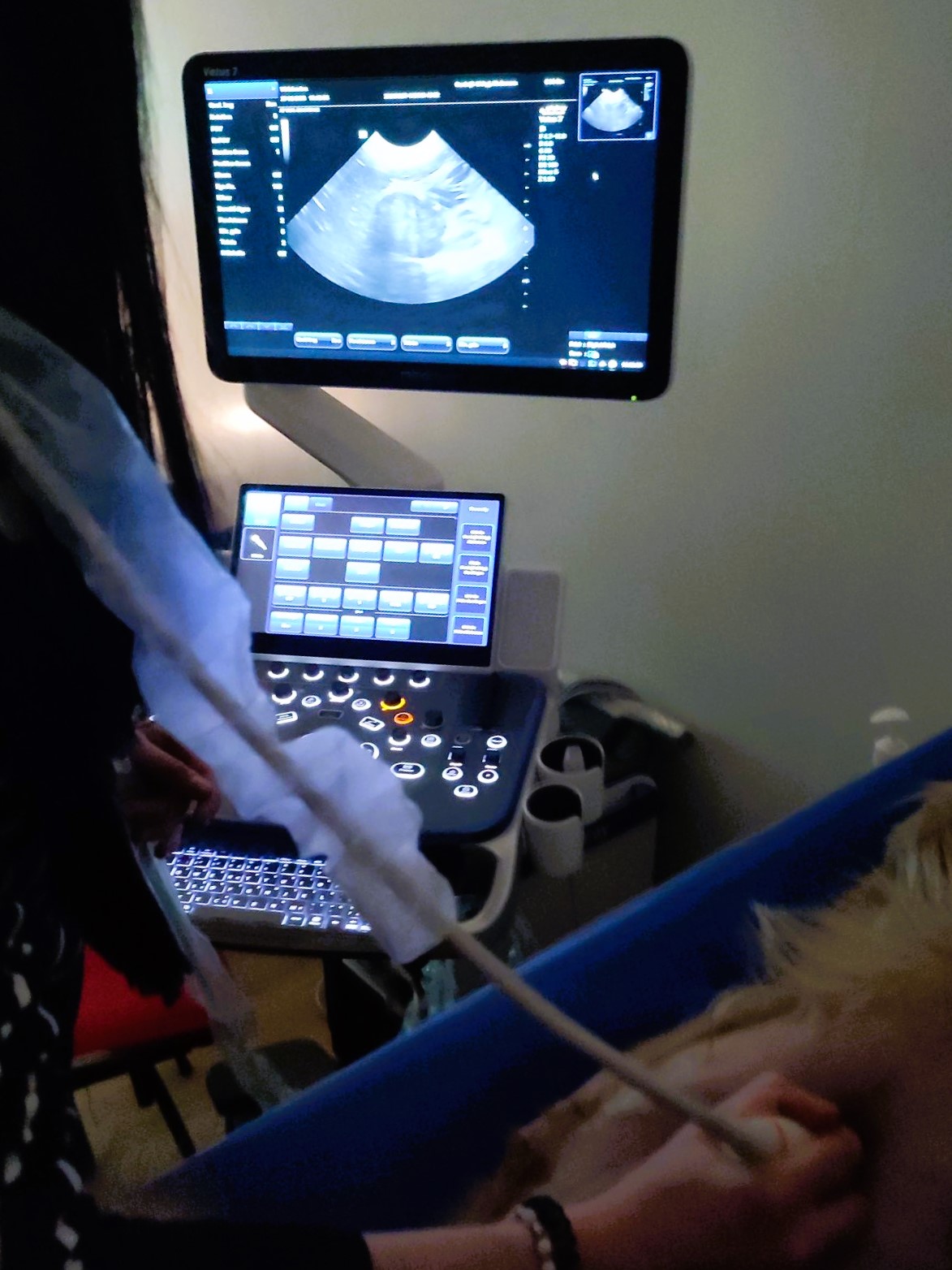 Formation EAN1 : Echographie abdominale normale : Partie 1 - foie, rate, reins, vessie, appareil g&eacute;nital.
